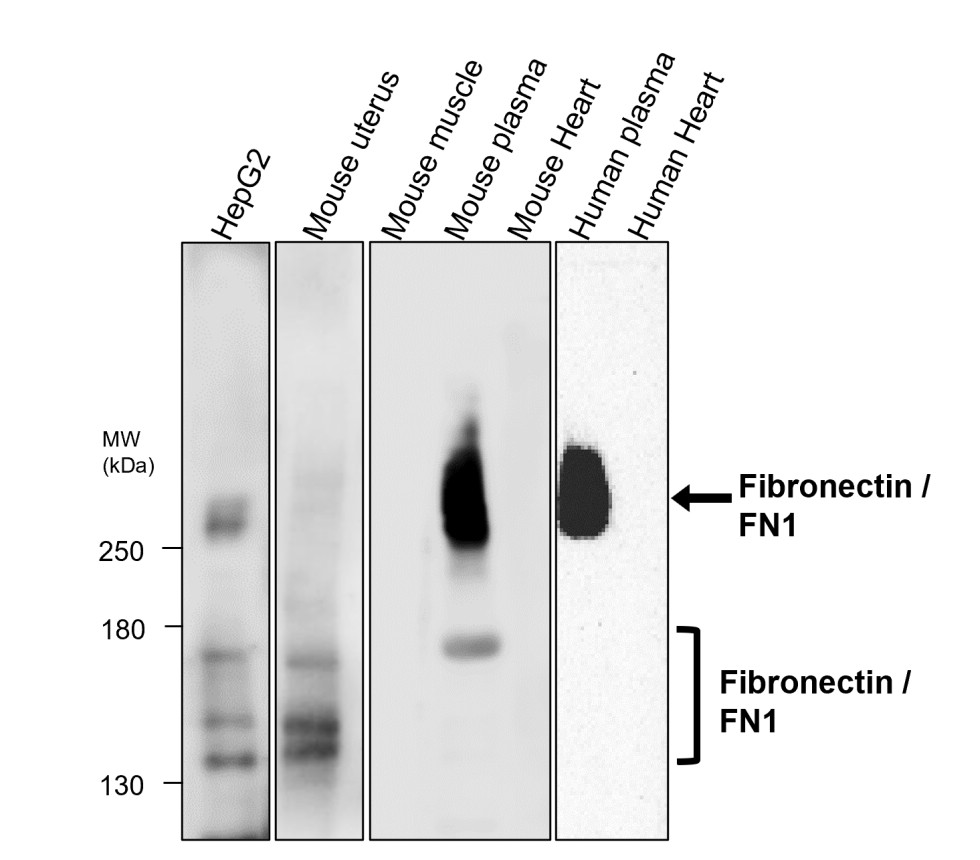 Fibronectin antibody