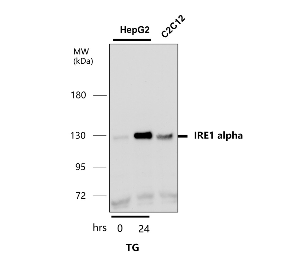 IRE1 alpha antibody