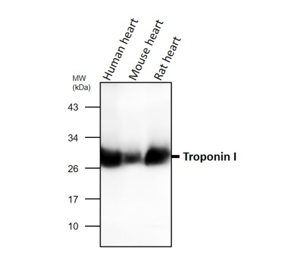 Troponin I antibody