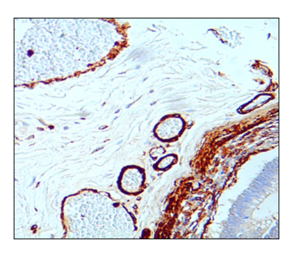 α-Smooth Muscle Actin antibody