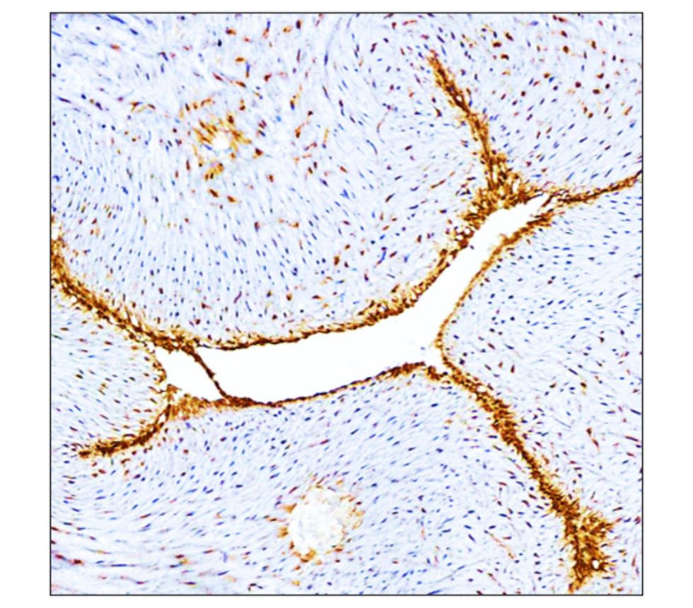 E-selectin / CD62E antibody