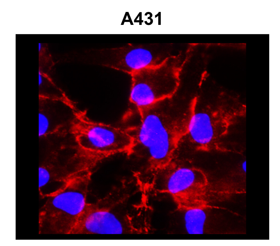 NaK ATPase alpha 1 antibody