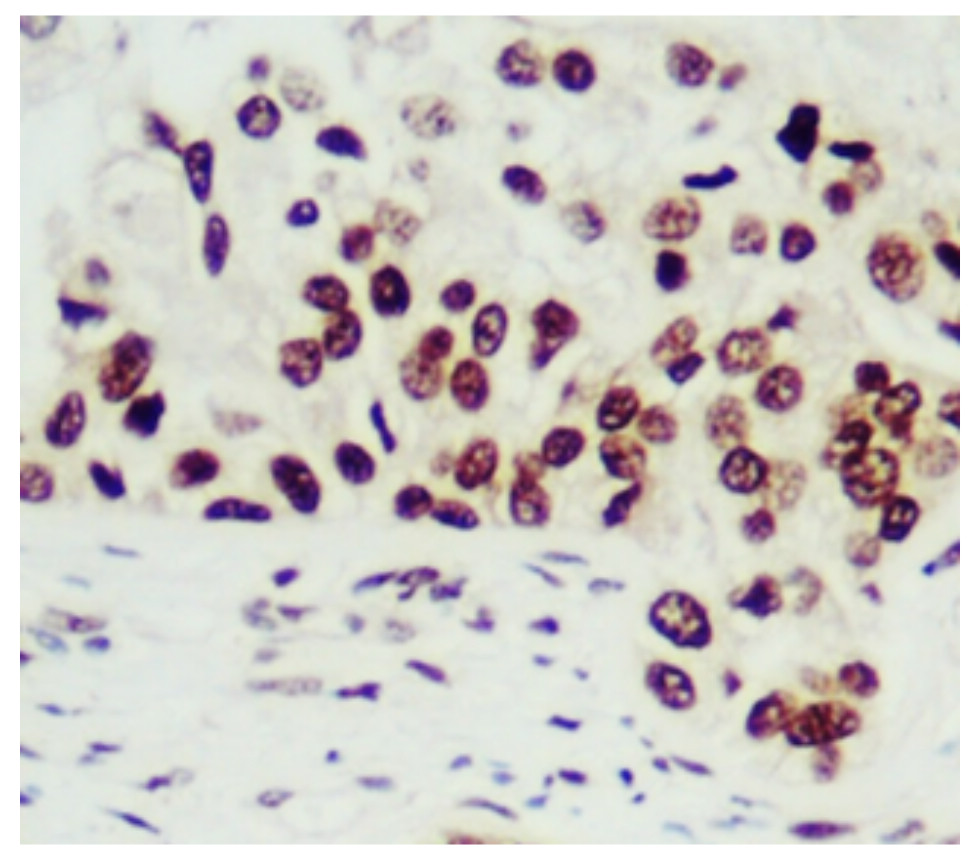 PCNA monoclonal antibody