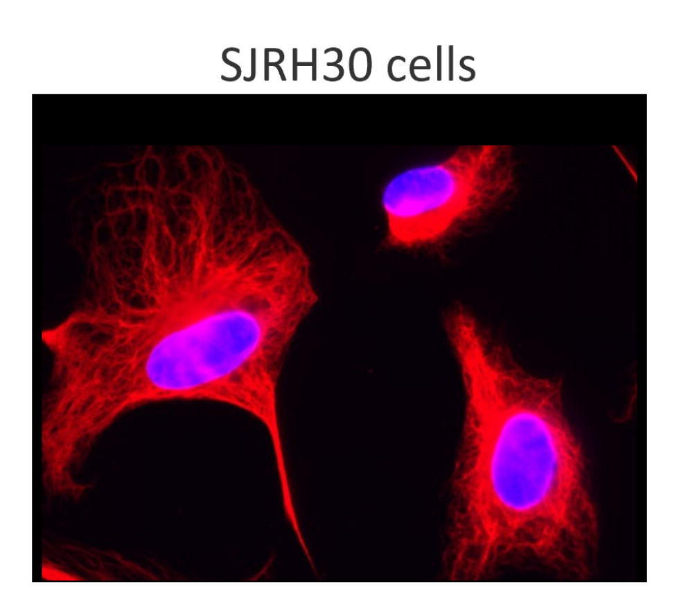 Desmin monolonal antibody