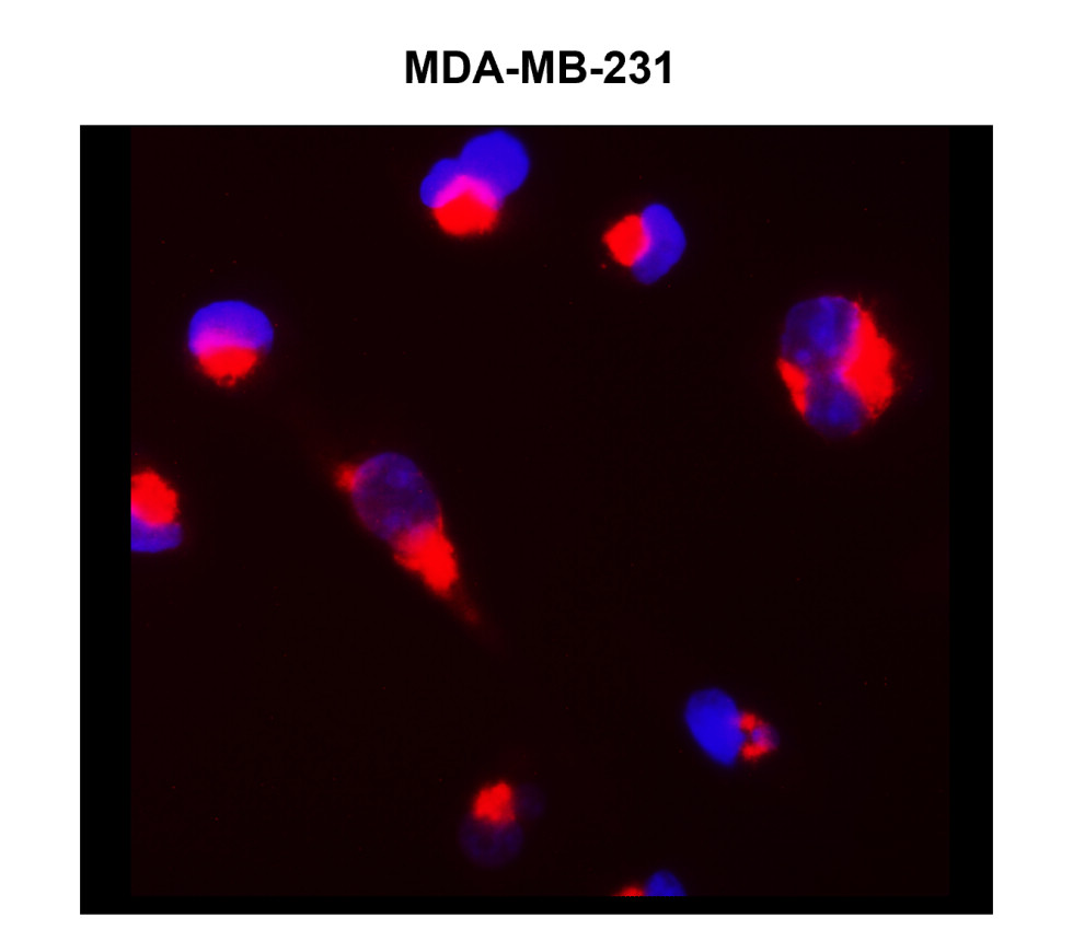 Cytokeratin 14/17 antibody