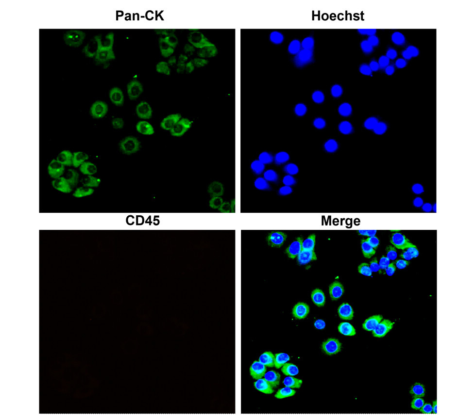 Pan- Cytokeratin antibody