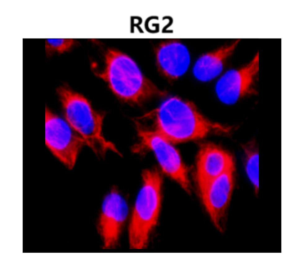 Vimentin antibody