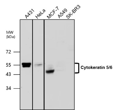 Cytokeratin 5/6 antibody