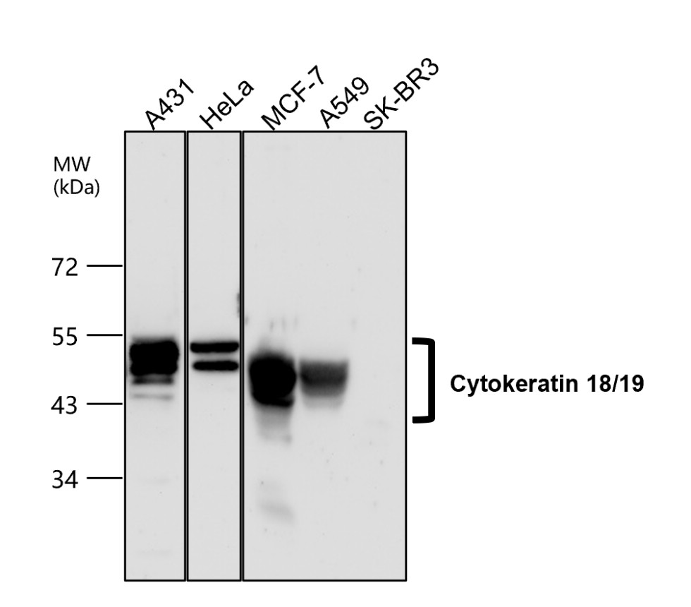 Cytokeratin 18/19 antibody