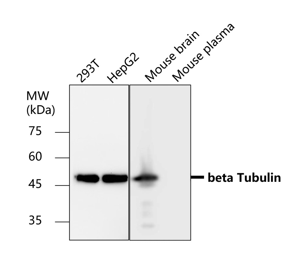 Beta-tubulin antibody