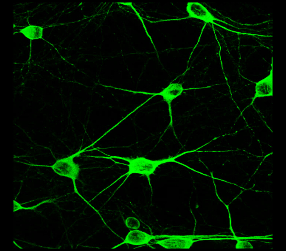 MAP2 antibody