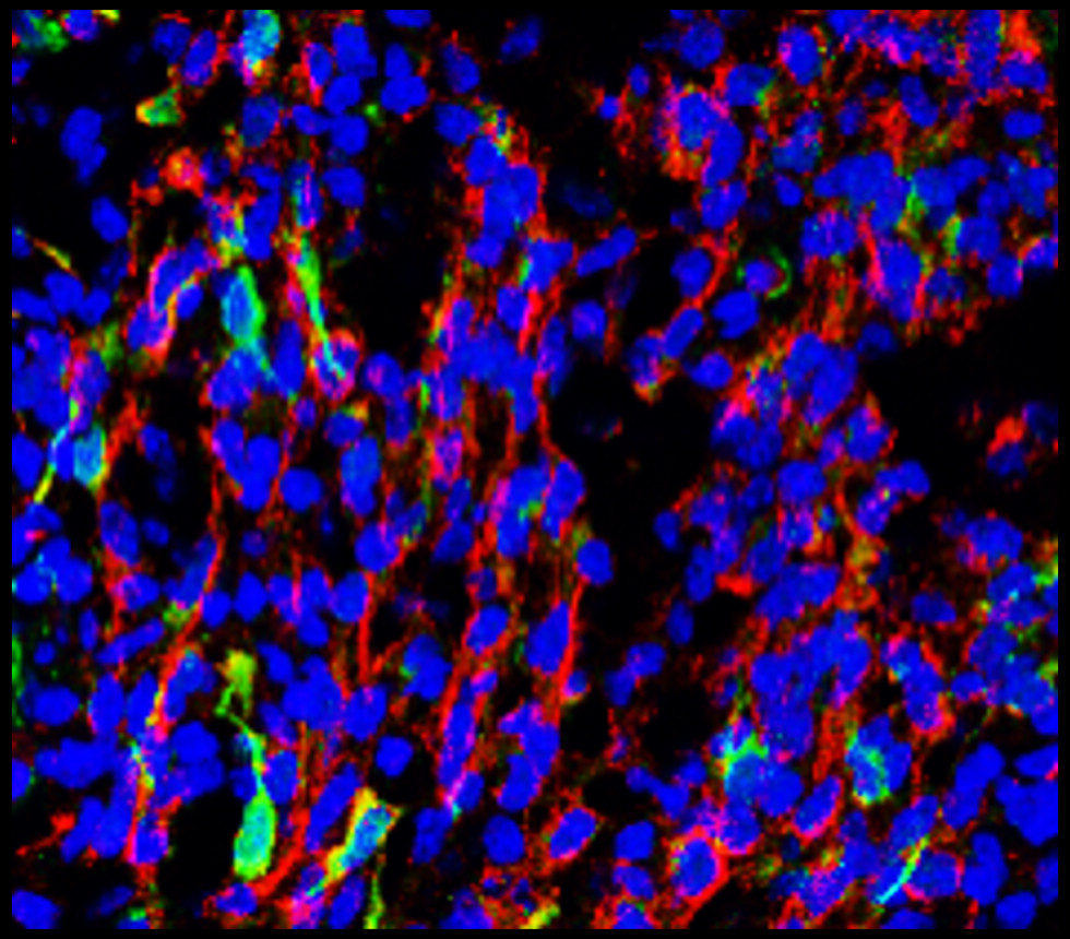 Tuj1 antibody