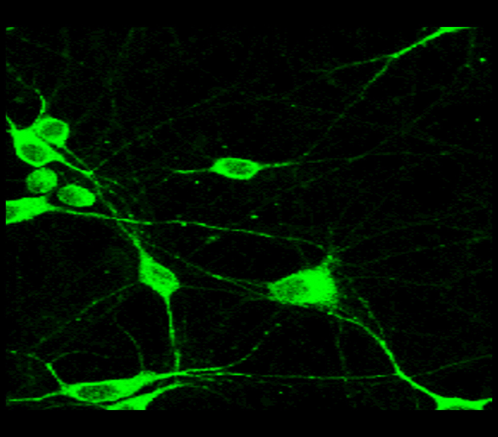 NF-H antibody