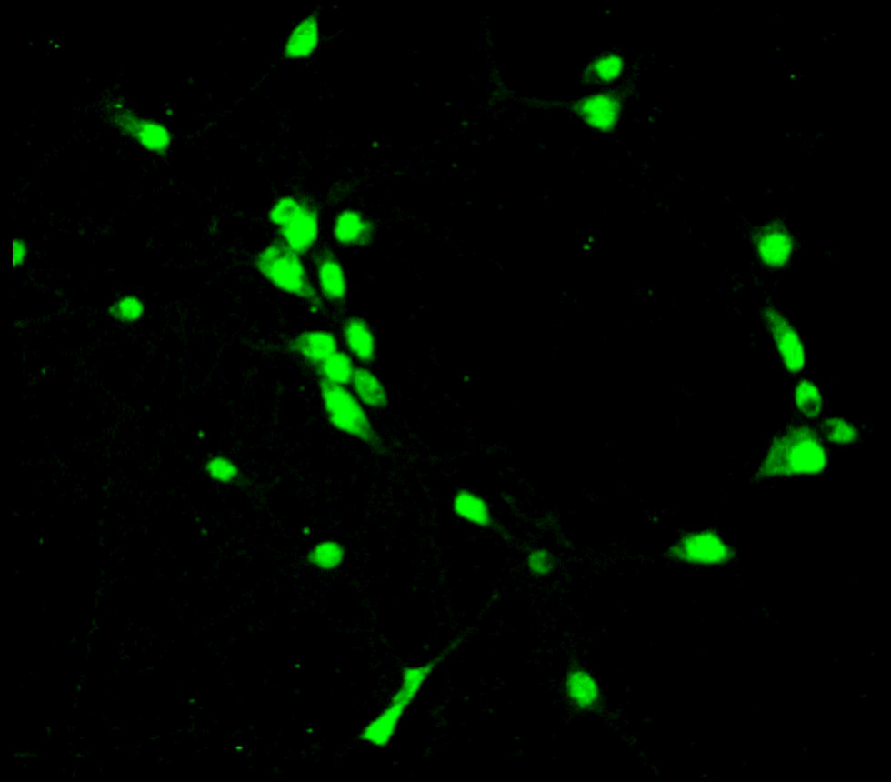 PAX6 antibody