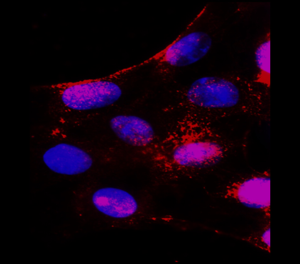 NOTCH1 antibody