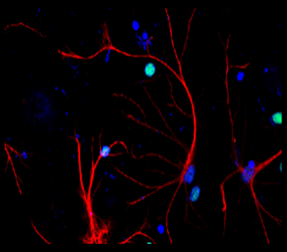 GFAP antibody