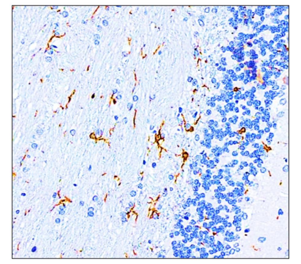 Iba1 antibody