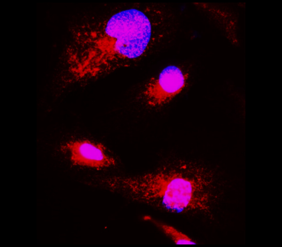 BDNF antibody