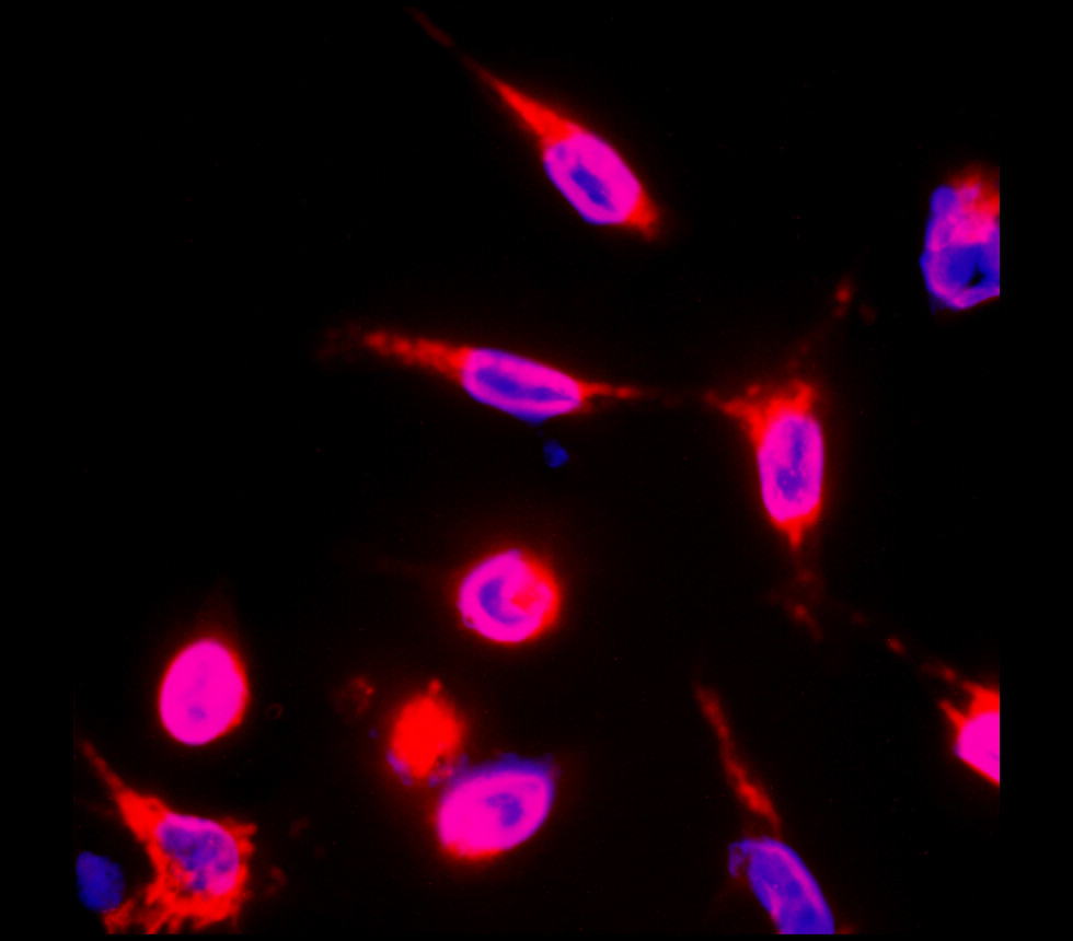 ICAM1 antibody