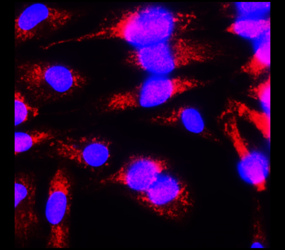 TNF alpha antibody