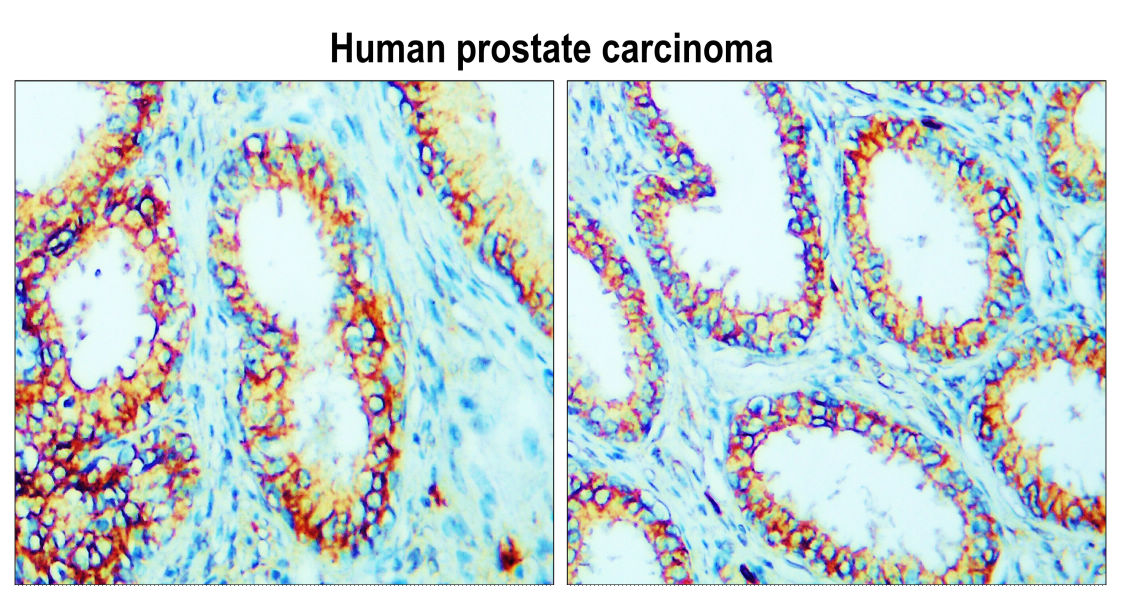 IR64-190 anti-Claudin 1 antibody IHC image