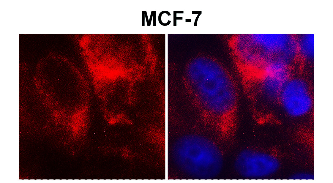 IR64-190 anti-Claudin 1 antibody ICC/IF image