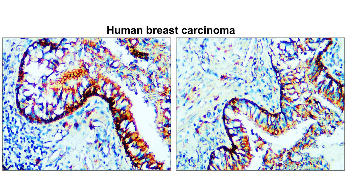 IR64-190 anti-Claudin 1 antibody IHC image