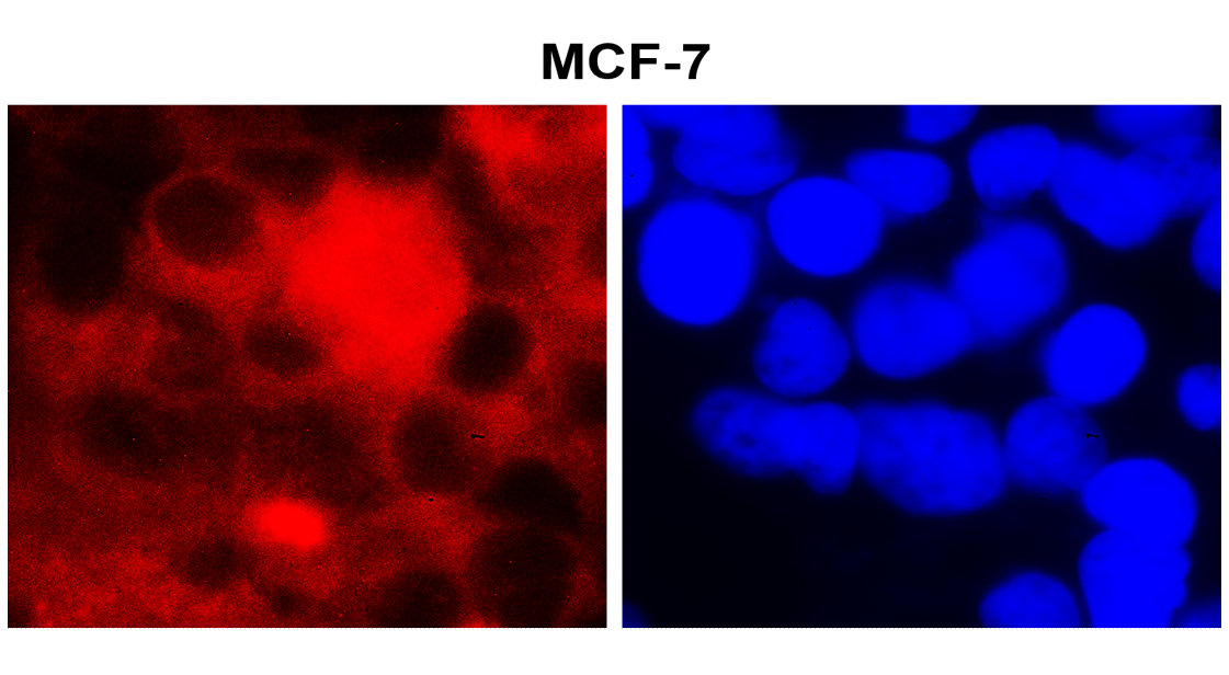 IR342-925 anti-Fatty Acid Synthase antibody  ICC/IF image