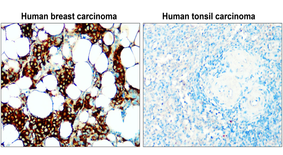 IR342-925 anti-Fatty Acid Synthase antibody  IHC image