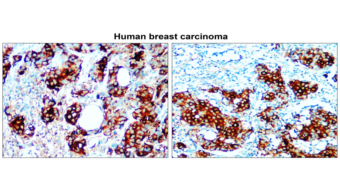 IR342-925 anti-Fatty Acid Synthase antibody  IHC image