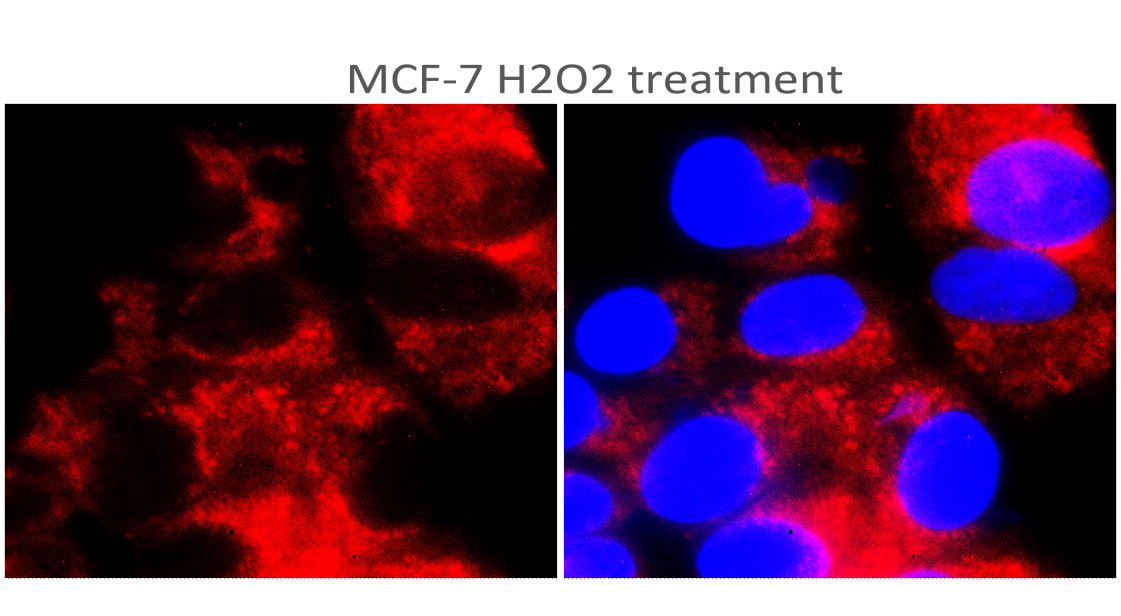 IR356-2 anti-TERT antibody ICC image