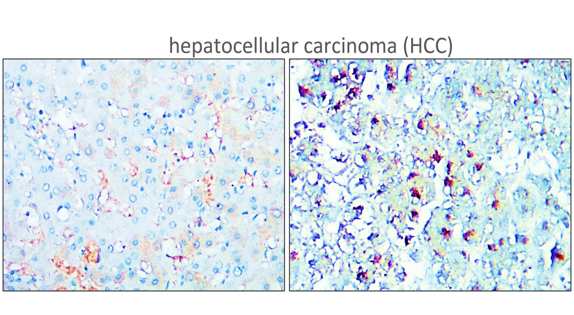 IR356-2 anti-TERT antibody IHC image