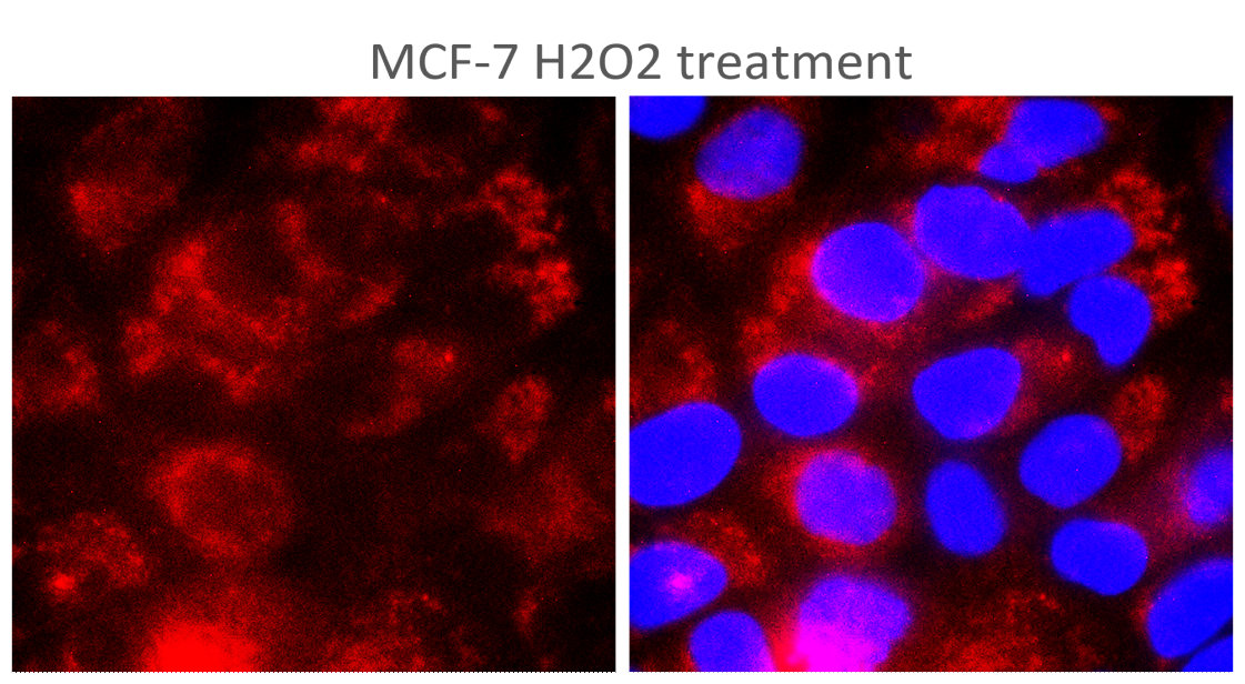 IR356-4 anti-TERT antibody ICC image