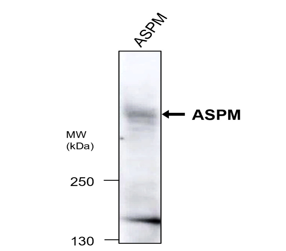 IR353-1 anti-ASPM antibody  WB image