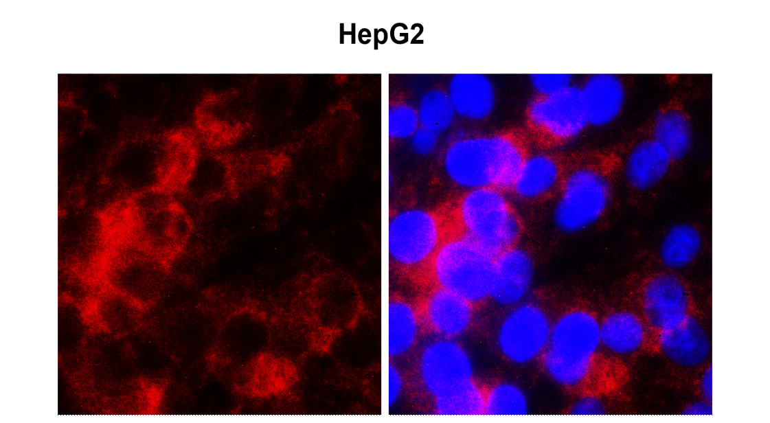 IR353-1 anti-ASPM antibody  ICC image