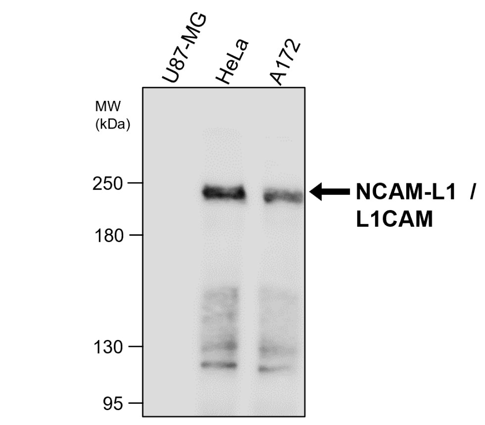 IRM207 NCAM-L1 / L1CAM antibody [212A03] WB image 