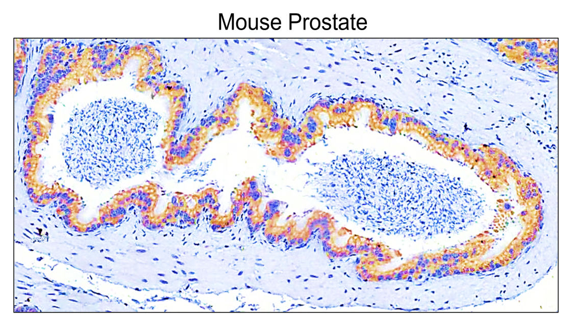 IR292-962 anti-COL1A1 / Collagen I antibody IHC image