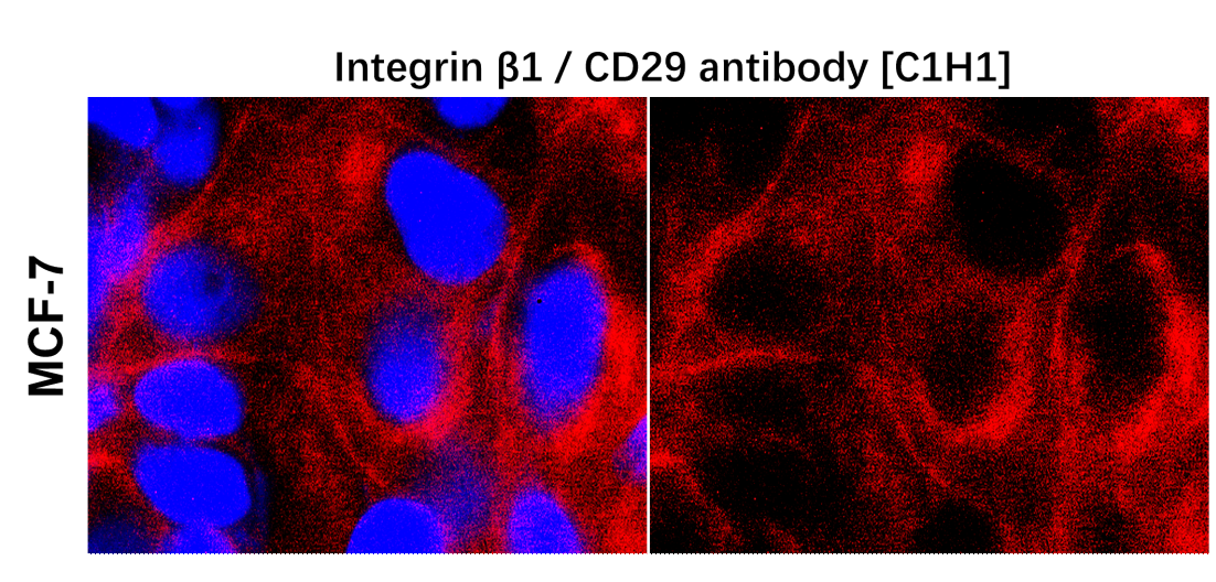 IRM202 Integrin β1 / CD29 antibody [C1H1]  ICC/IF image