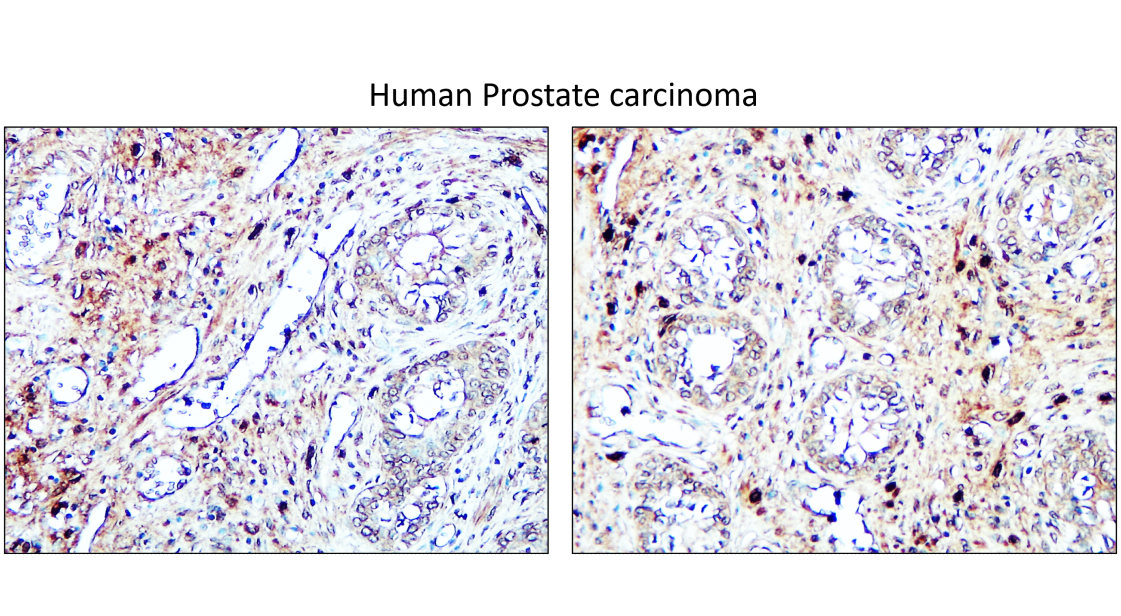 IRCP220601 anti-IGLC2 antibody IHC image