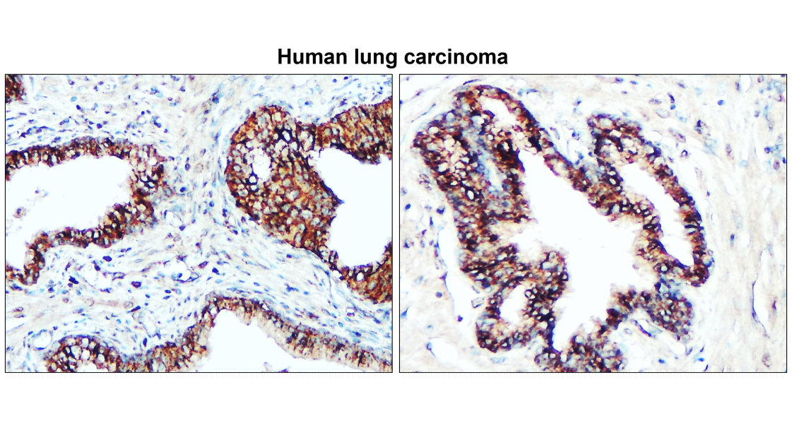 IR64-190 anti-Claudin 1 antibody IHC image