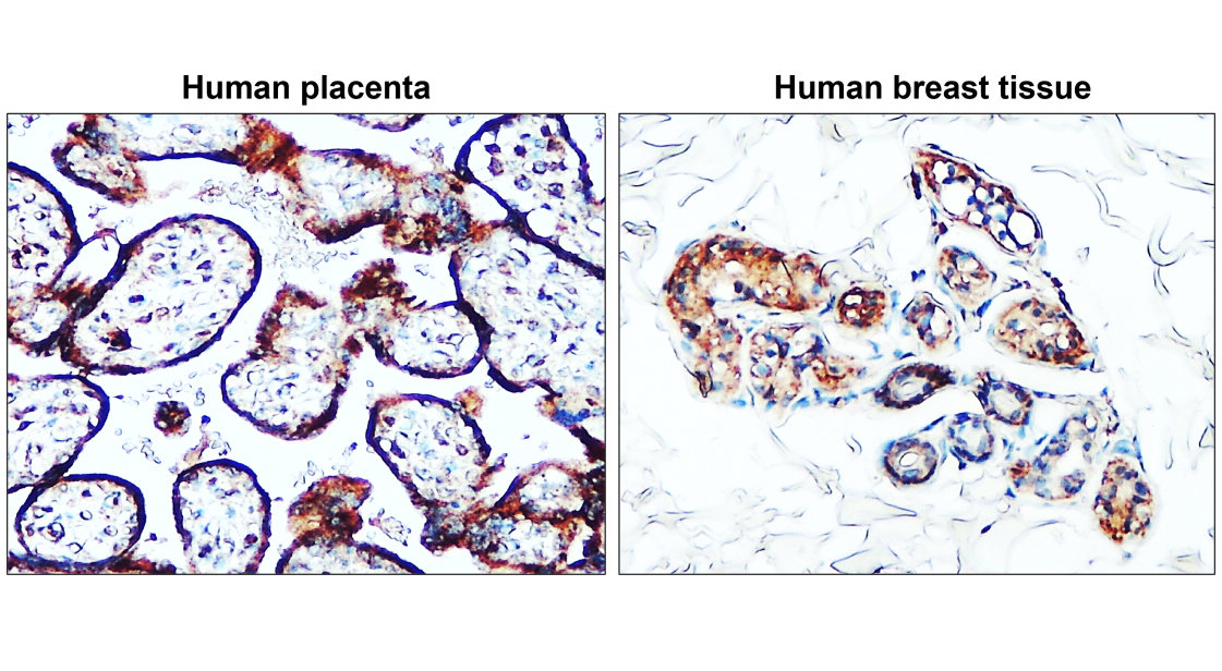 IR64-190 anti-Claudin 1 antibody IHC image