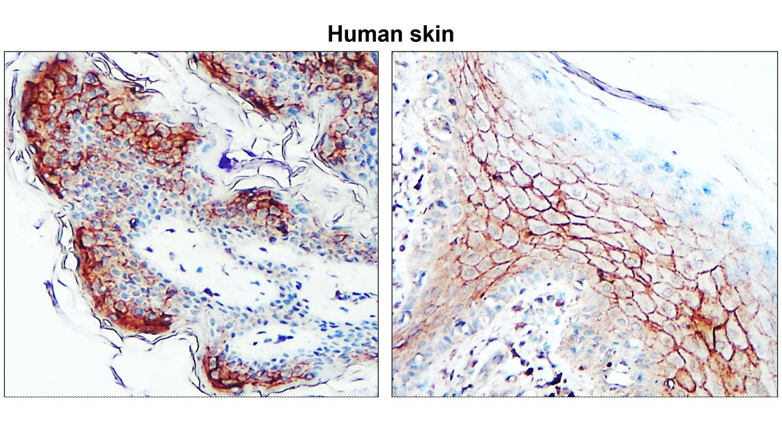 IR64-190 anti-Claudin 1 antibody IHC image