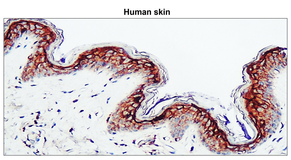 IR64-190 anti-Claudin 1 antibody IHC image