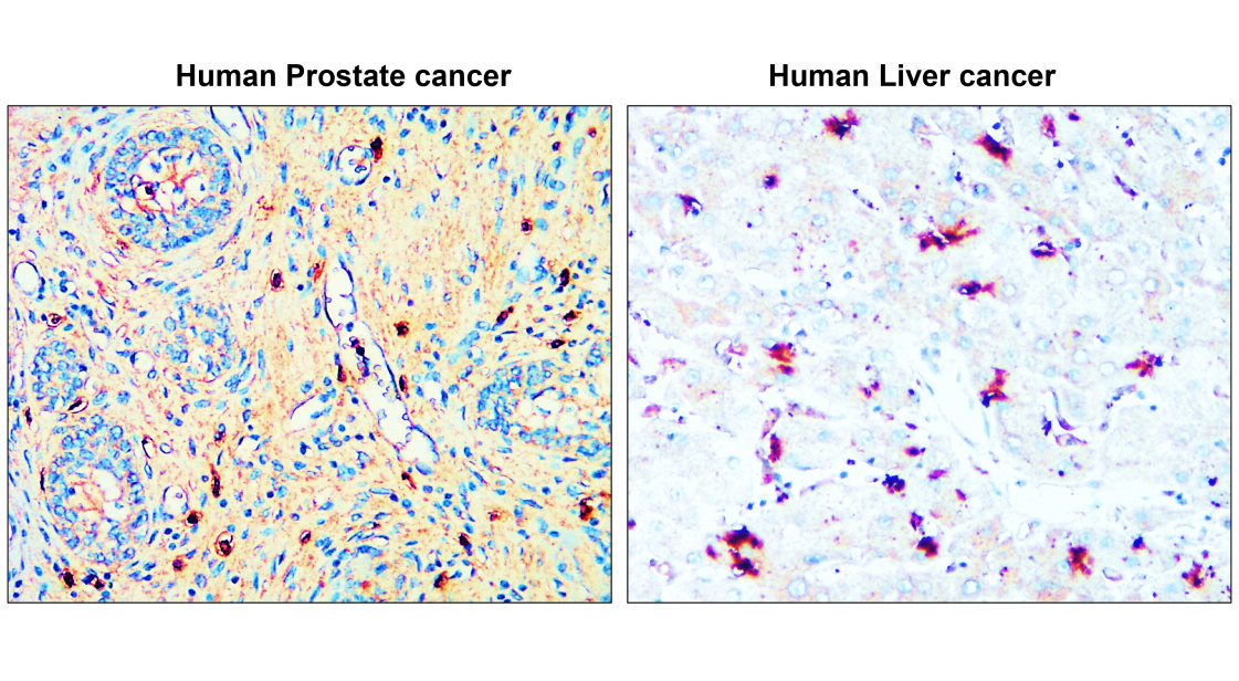 IR353-1 anti-ASPM antibody  IHC image