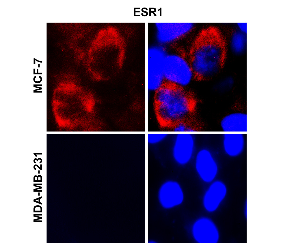 IRM201 Estrogen receptor alpha / ESR1 antibody [SC1]  ICC/IF image