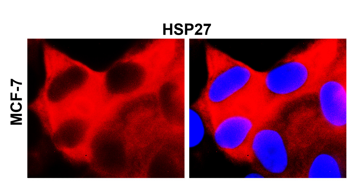 IRM209 HSP27 antibody [9C2] ICC/IF image