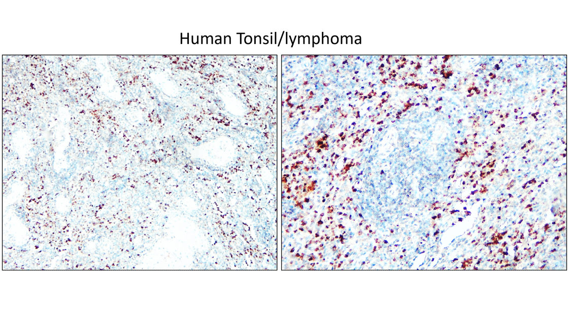 IRCP220602 anti-IGLC2 antibody IHC image