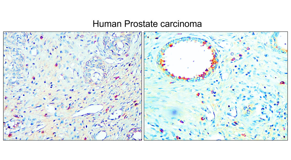 IRCP220602 anti-IGLC2 antibody IHC image