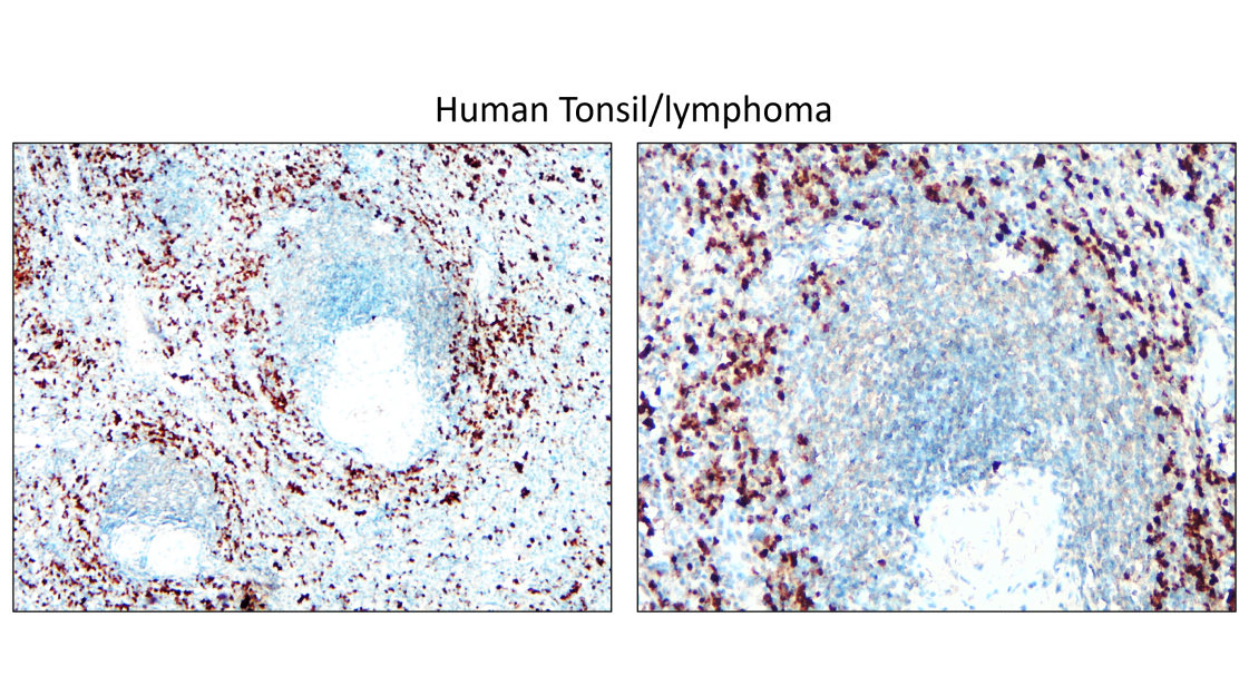 IRCP220601 anti-IGLC2 antibody IHC image