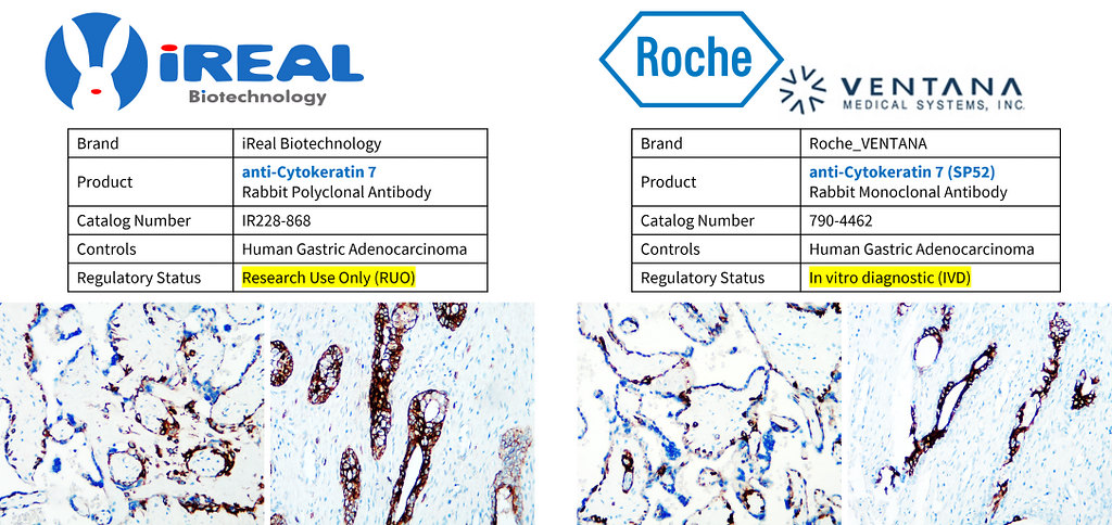 IR228-868 anti-Cytokeratin 7 antibody IHC image